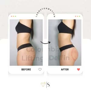 spoiledlaser